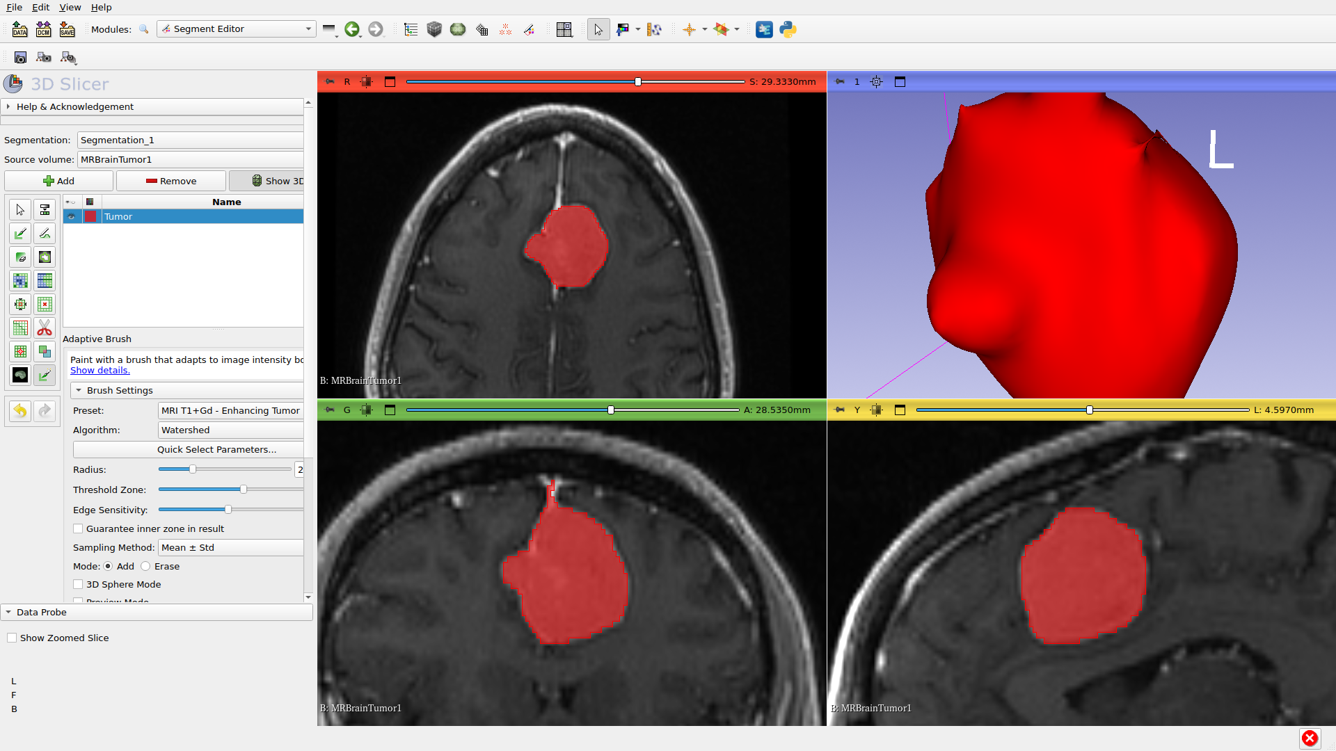 3D visualization of segmentation