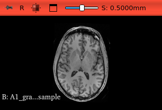 Axial view of input volume