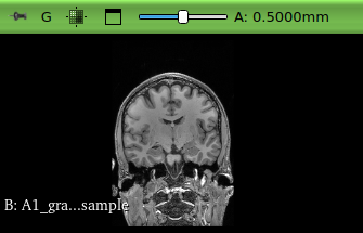 Coronal view of input volume