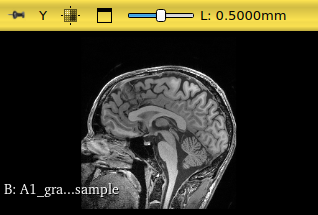 Sagittal view of input volume