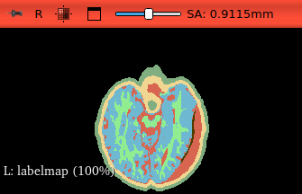 Axial view of label map