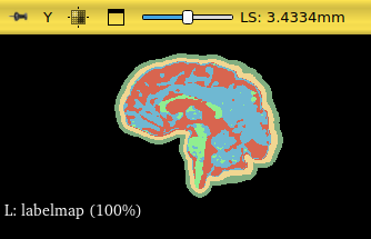 Sagittal view of label map